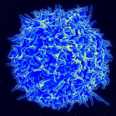 인간의 T세포[출처=위키피디아]