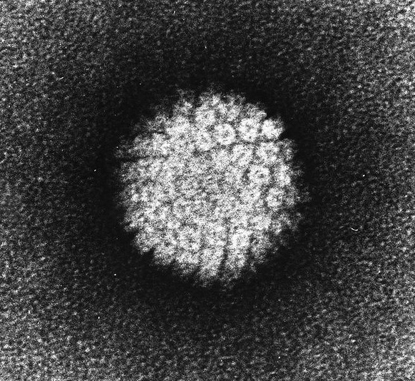 사마귀에서 인간 유두종 바이러스의 전자 현미경 사진