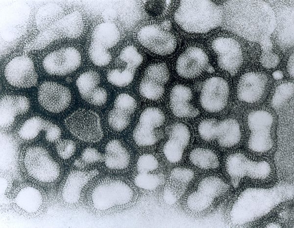 조류엔자플엔자를 일으키는 인플루엔자바이러스 A형.