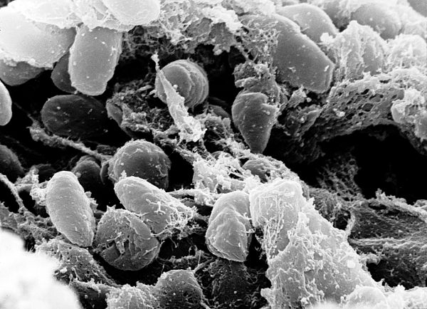 Yersinia pestis 박테리아 의 질량을 묘사 한 주사 전자 현미경 사진 .