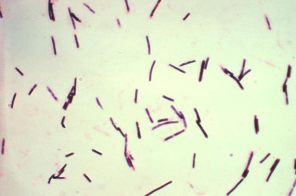 염색 된 클로스트리디움 퍼프린젠스의 현미경 사진