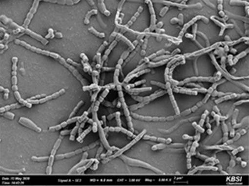 균주 SJ1-7 포자의 주사전자현미경 사진