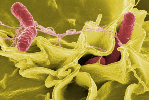 살모넬라의 주사 전자 현미경 사진
