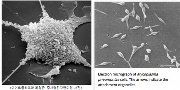 마이코플라스마 폐렴균의 주사형전자현미경 사진 /이미지=제주감염병관리지원단, CDC