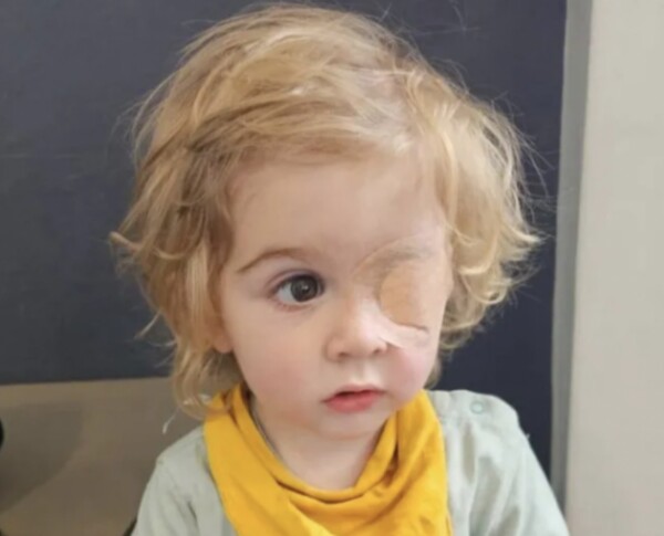 영국에서 성인의 뽀뽀로 헤르페스에 감염돼 한쪽 눈 시력을 잃은 주완/메트로 보도 갈무리(포인트경제)