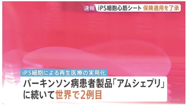 [오늘 일본은] 日 중증 심부전용 iPS 치료제 보험 적용...재생의료 확대 - 뉴스 썸네일 이미지